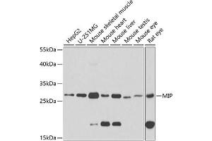 Western blot analysis of extracts of various cell lines, using MIP antibody (ABIN3016917, ABIN3016918, ABIN3016919 and ABIN6219879) at 1:1000 dilution. (Mip (AA 50-150) antibody)