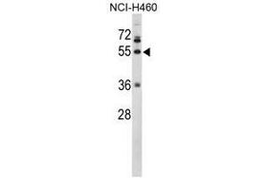 Image no. 1 for anti-Fibrinogen gamma Chain (FGG) (C-Term), (Chain gamma) antibody (ABIN453006) (FGG antibody  (C-Term, Chain gamma))
