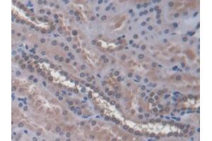 IHC-P analysis of Human Kidney Tissue, with DAB staining. (SLC30A8 antibody  (AA 263-369))