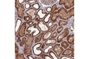 Immunohistochemical staining of human kidney with NDUFC1 polyclonal antibody  shows strong cytoplasmic positivity in cells in tubules.