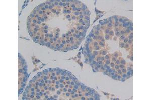 Used in DAB staining on fromalin fixed paraffin- embedded Kidney tissue (GMFB antibody  (AA 2-142))