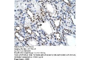 Human kidney (ILF2 antibody  (C-Term))