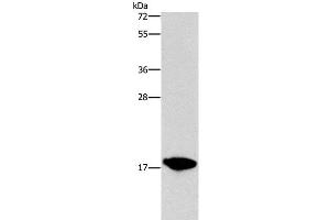 Western Blot analysis of HepG2 cell using CCL16 Polyclonal Antibody at dilution of 1:760 (CCL16 antibody)