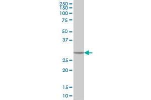 CA1 monoclonal antibody (M05), clone M1 Western Blot analysis of CA1 expression in HeLa . (CA1 antibody  (AA 1-261))