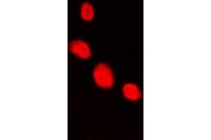 Immunofluorescent analysis of LHX1 staining in HepG2 cells. (LHX1 antibody  (Center))