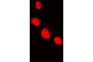 Immunofluorescent analysis of LHX1 staining in HepG2 cells. (LHX1 antibody  (Center))