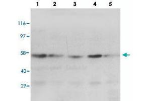 Lane 1 : MM453 whole cell lysate. (PPARG antibody  (N-Term))