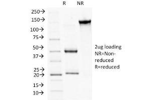 SDS-PAGE Analysis Purified CD56 Monoclonal Antibody (NCAM1/784).