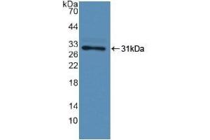 Detection of Recombinant F13A1, Human using Polyclonal Antibody to Coagulation Factor XIII A1 Polypeptide (F13A1) (F13A1 antibody  (AA 107-345))