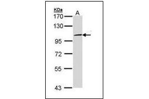 Sample (30 µg of whole cell lysate). (TLR3 antibody)