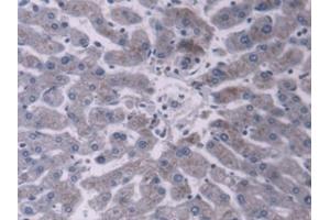 #VALUE! (PDIA5 antibody  (AA 378-506))