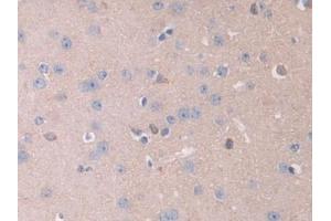 Detection of IL13Ra2 in Mouse Cerebrum Tissue using Polyclonal Antibody to Interleukin 13 Receptor Alpha 2 (IL13Ra2) (IL13RA2 antibody  (AA 228-338))