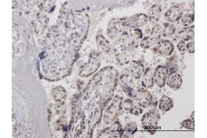 Immunoperoxidase of  purified  MaxPab antibody to HMG20A on formalin-fixed paraffin-embedded human placenta. (HMG20A antibody  (AA 1-347))