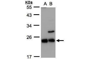 WB Image Sample(30 ug whole cell lysate) A:293T B:Raji , 12% SDS PAGE antibody diluted at 1:1000 (CBFB antibody)