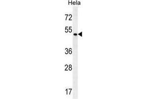 ZMYND17 Antibody (C-term) western blot analysis in Hela cell line lysates (35 µg/lane). (ZMYND17 antibody  (C-Term))
