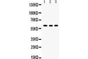 Western Blotting (WB) image for anti-V-Yes-1 Yamaguchi Sarcoma Viral Oncogene Homolog 1 (YES1) (AA 7-35), (N-Term) antibody (ABIN3042333) (YES1 antibody  (N-Term))