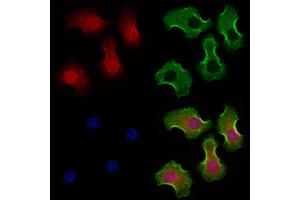ABIN6264173 and ABIN6273295 staining Hela cells by IF/ICC.