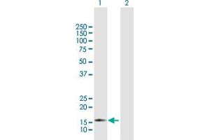 Western Blot analysis of ZMAT4 expression in transfected 293T cell line by ZMAT4 MaxPab polyclonal antibody. (ZMAT4 antibody  (AA 1-153))
