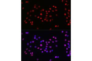 Immunofluorescence analysis of PC-12 cells using Acetyl-Histone H3-K27 Rabbit mAb (ABIN3016650, ABIN3016651, ABIN3016652, ABIN1682513 and ABIN1682514) at dilution of 1:100 (40x lens). (Histone 3 antibody  (acLys27))