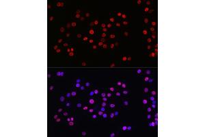 Immunofluorescence analysis of PC-12 cells using Acetyl-Histone H3-K27 Rabbit mAb (ABIN3016650, ABIN3016651, ABIN3016652, ABIN1682513 and ABIN1682514) at dilution of 1:100 (40x lens). (Histone H3 (Acetyl K27) (acLys27) antibody)