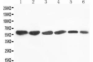 Anti-Flavin containing monooxygenase 4 antibody, Western blotting Lane 1: Rat Liver Tissue Lysate Lane 2: Mouse Liver Tissue Lysate Lane 3: SMMC Cell Lysate Lane 4: HEPA Cell Lysate Lane 5: A431 Cell Lysate Lane 6: MCF-7 Cell Lysate (FMO4 antibody  (N-Term))