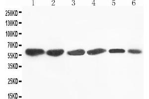 Anti-Flavin containing monooxygenase 4 antibody, Western blotting Lane 1: Rat Liver Tissue Lysate Lane 2: Mouse Liver Tissue Lysate Lane 3: SMMC Cell Lysate Lane 4: HEPA Cell Lysate Lane 5: A431 Cell Lysate Lane 6: MCF-7 Cell Lysate
