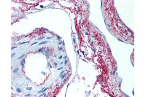 Anti-Elastin antibody IHC of human skeletal muscle, vessels. (Elastin antibody)