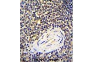 Immunohistochemistry (IHC) image for anti-ArfGAP with Coiled-Coil, Ankyrin Repeat and PH Domains 1 (ACAP1) antibody (ABIN2996040) (ACAP1 antibody)