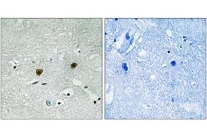 Immunohistochemistry analysis of paraffin-embedded human brain, using AKT1/2/3 (Phospho-Tyr315/316/312) Antibody. (AKT 1/2/3 antibody  (pTyr315))