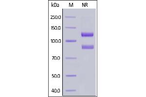 Human ITGAIIb&ITGB3 Heterodimer Protein, His Tag&Tag Free on  under ing (NR) condition. (Integrin alpha 2b beta 3 (AA 32-993) (Active) protein (His tag))