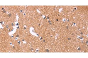 Immunohistochemistry of paraffin-embedded Human brain using MAPK11 Polyclonal Antibody at dilution of 1:30 (MAPK11 antibody)