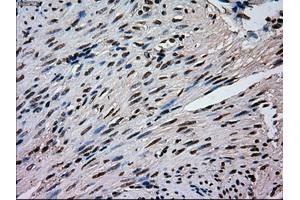Immunohistochemical staining of paraffin-embedded pancreas tissue using anti-MAPK1mouse monoclonal antibody. (ERK2 antibody)