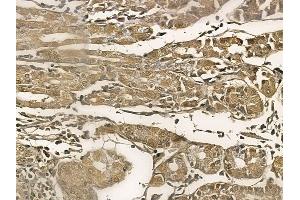 KLHL4 Mouse Monoclonal Antibody at 1/100 staining human normal gastric tissue by IHC-P.