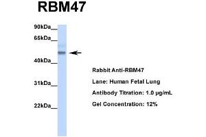 Host: Rabbit  Target Name: RBM47  Sample Tissue: Human Fetal Lung  Antibody Dilution: 1. (RBM47 antibody  (Middle Region))