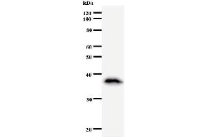 Western Blotting (WB) image for anti-Matrin 3 (MATR3) antibody (ABIN933126) (MATR3 antibody)