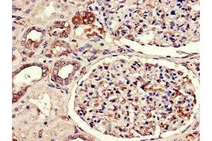 Immunohistochemistry of paraffin-embedded human kidney tissue using ABIN7175380 at dilution of 1:100 (FLT1 antibody  (AA 1048-1328))