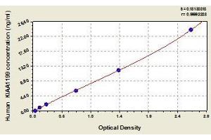 CEMIP ELISA Kit