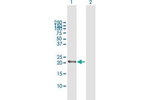 Western Blot analysis of RGS5 expression in transfected 293T cell line by RGS5 MaxPab polyclonal antibody. (RGS5 antibody  (AA 1-181))