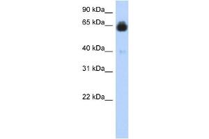 IGFALS antibody used at 1 ug/ml to detect target protein. (IGFALS antibody  (Middle Region))