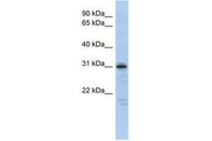 Image no. 1 for anti-Homeobox D9 (HOXD9) (AA 143-192) antibody (ABIN6742472)