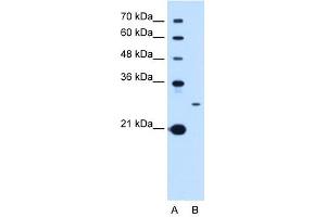 Tetraspanin 15 antibody used at 1 ug/ml to detect target protein. (Tetraspanin 15 antibody  (C-Term))