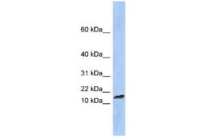 WB Suggested Anti-TAL2 Antibody Titration:  0.