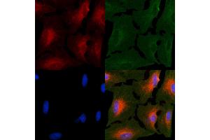ABIN6264142 and ABIN6266623 staining  cells by IF/ICC. (Peripherin antibody  (C-Term))