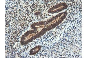 Image no. 11 for anti-Leucine Zipper and CTNNBIP1 Domain Containing (LZIC) antibody (ABIN1499239) (LZIC antibody)