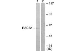 Western blot analysis of extracts from A549 cells, treated with EGF 200ng/ml 30', using DRP-2 (Ab-514) Antibody. (DRP2 antibody  (AA 480-529))