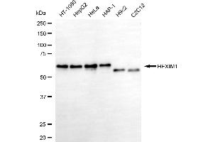 Western blotting analysis using HEXIM1 antibody (ABIN7798905).