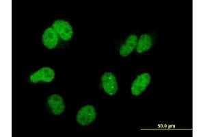 Immunofluorescence of monoclonal antibody to CAND1 on HeLa cell. (CAND1 antibody  (AA 1-100))