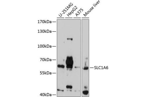 SLC1A6 antibody  (AA 155-265)