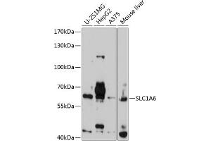 Western blot analysis of extracts of various cell lines, using SLC1 antibody  at 1:1000 dilution. (SLC1A6 antibody  (AA 155-265))