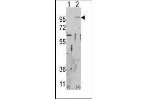 Western blot analysis of FGFR2 (arrow) using rabbit polyclonal FGFR2 Antibody.